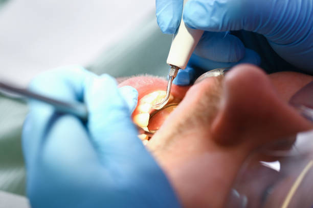 Best Cracked Tooth Emergency Dentist  in Rpinteria, CA